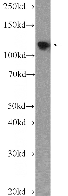 A2780 cells were subjected to SDS PAGE followed by western blot with Catalog No:113303(NOP2 Antibody) at dilution of 1:2000