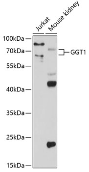 Western blot - GGT1 Polyclonal Antibody 