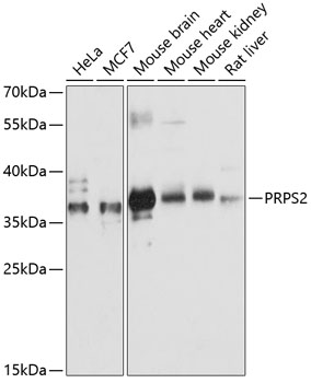 Western blot - PRPS2 Polyclonal Antibody 