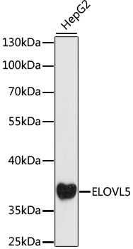 Western blot - ELOVL5 Polyclonal Antibody 