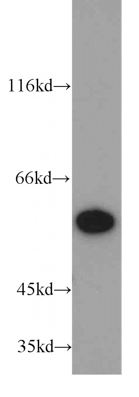 MCF7 cells were subjected to SDS PAGE followed by western blot with Catalog No:113861(PK-M2-specific antibody) at dilution of 1:1500