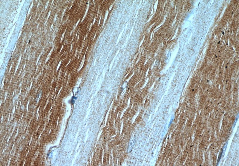 Immunohistochemical of paraffin-embedded human skeletal muscle using Catalog No:112181(LDHA antibody) at dilution of 1:50 (under 40x lens)