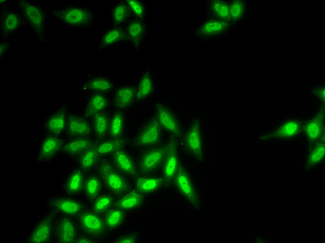 Immunofluorescence - SETMAR Polyclonal Antibody 