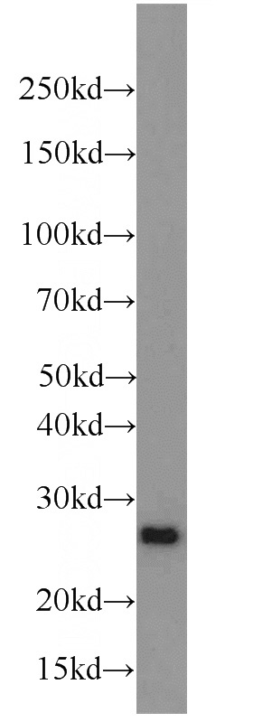 HEK-293 cells were subjected to SDS PAGE followed by western blot with Catalog No:114175(PRDX1 antibody) at dilution of 1:1000