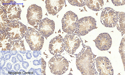 Immunohistochemical analysis of paraffin-embedded Mouse-testis tissue. 1,PI 3-kinase p85α (phospho Tyr607) Polyclonal Antibody was diluted at 1:200(4°C,overnight). 2, Sodium citrate pH 6.0 was used for antibody retrieval(>98°C,20min). 3,Secondary antibody was diluted at 1:200(room tempeRature, 30min). Negative control was used by secondary antibody only.