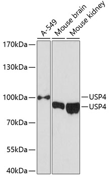 Western blot - USP4 Polyclonal Antibody 