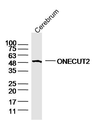 Fig2: Sample:Cerebrum (Mouse) Lysate at 40 ug; Primary: Anti-ONECUT2 at 1/300 dilution; Secondary: IRDye800CW Goat Anti-Rabbit IgG at 1/20000 dilution; Predicted band size: 52 kD; Observed band size: 52 kD
