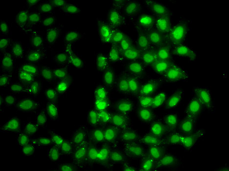 Immunofluorescence - PSMD8 Polyclonal Antibody 