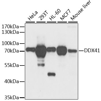Western blot - DDX41 Polyclonal Antibody 
