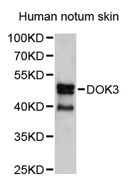 Western blot - DOK3 Polyclonal Antibody 
