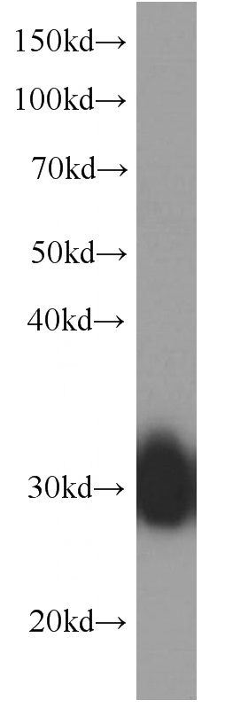 human plasma tissue were subjected to SDS PAGE followed by western blot with Catalog No:107064(APOD Antibody) at dilution of 1:20000