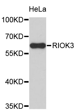 Western blot - RIOK3 Polyclonal Antibody 