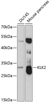 Western blot - KLK2 Polyclonal Antibody 