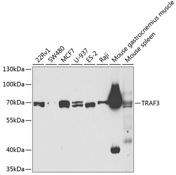 Western blot - TRAF3 Polyclonal Antibody 