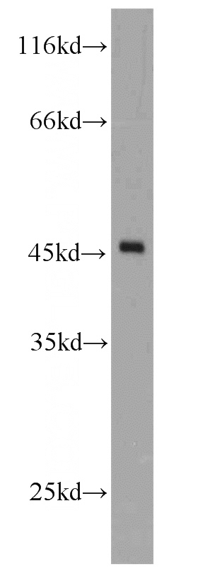 mouse kidney tissue were subjected to SDS PAGE followed by western blot with Catalog No:109974(Doc2B antibody) at dilution of 1:600