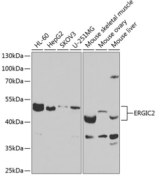 Western blot - ERGIC2 Polyclonal Antibody 