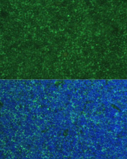 Immunofluorescence - PMAIP1 Polyclonal Antibody 