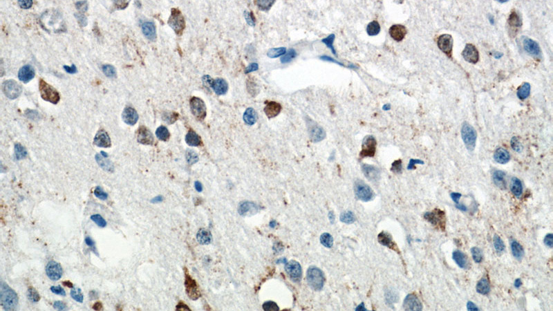 Immunohistochemistry of paraffin-embedded human brain tissue slide using Catalog No:111667(RABL4 Antibody) at dilution of 1:50 (under 40x lens)