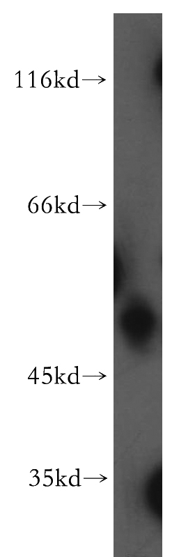 K-562 cells were subjected to SDS PAGE followed by western blot with Catalog No:109647(CXCR7-Specific antibody) at dilution of 1:100