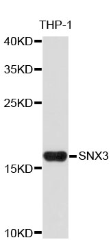 Western blot - SNX3 Polyclonal Antibody 