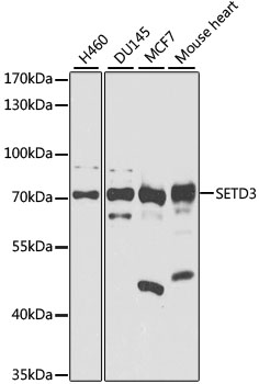 Western blot - SETD3 Polyclonal Antibody 