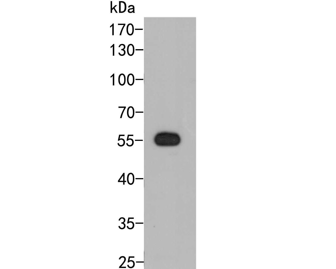Fig1:; Western blot analysis of PHR2 on rice tissue lysate. Proteins were transferred to a PVDF membrane and blocked with 5% BSA in PBS for 1 hour at room temperature. The primary antibody ( 1/500) was used in 5% BSA at room temperature for 2 hours. Goat Anti-Rabbit IgG - HRP Secondary Antibody (HA1001) at 1:5,000 dilution was used for 1 hour at room temperature.