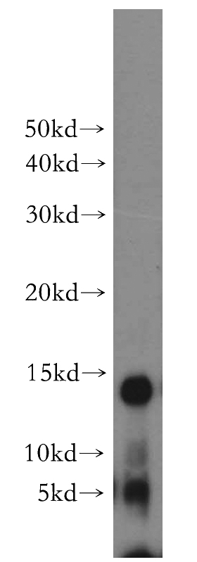 HeLa cells were subjected to SDS PAGE followed by western blot with Catalog No:114042(POLR2F antibody) at dilution of 1:500
