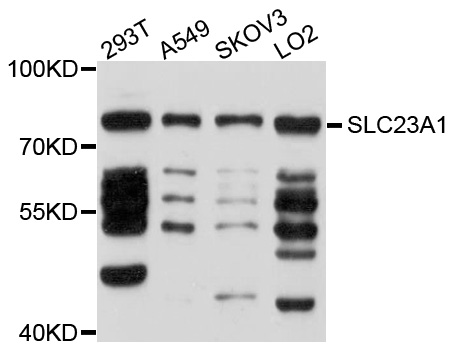 Western blot - SLC23A1 Polyclonal Antibody 