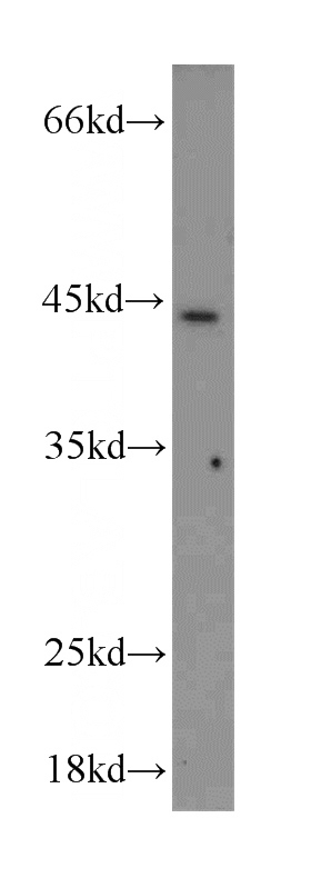 mouse liver tissue were subjected to SDS PAGE followed by western blot with Catalog No:111532(HOXB1 antibody) at dilution of 1:300