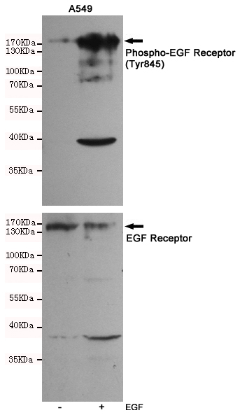 Western blot analysis of extracts of A549 cells, untreated or EGF-stimulated, using Phospho-EGF Receptor (Tyr845) Rabbit pAb (upper,1:500 diluted) and EGF Receptor Antibody 201012-6H11 (lower,1:500 diluted).
