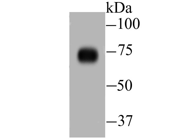 Fig1: Western blot analysis of DLL4 on human lung tissue lysate using anti-DLL4 antibody at 1/500 dilution.