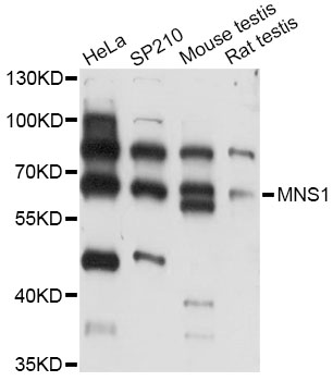 Western blot - MNS1 Polyclonal Antibody 