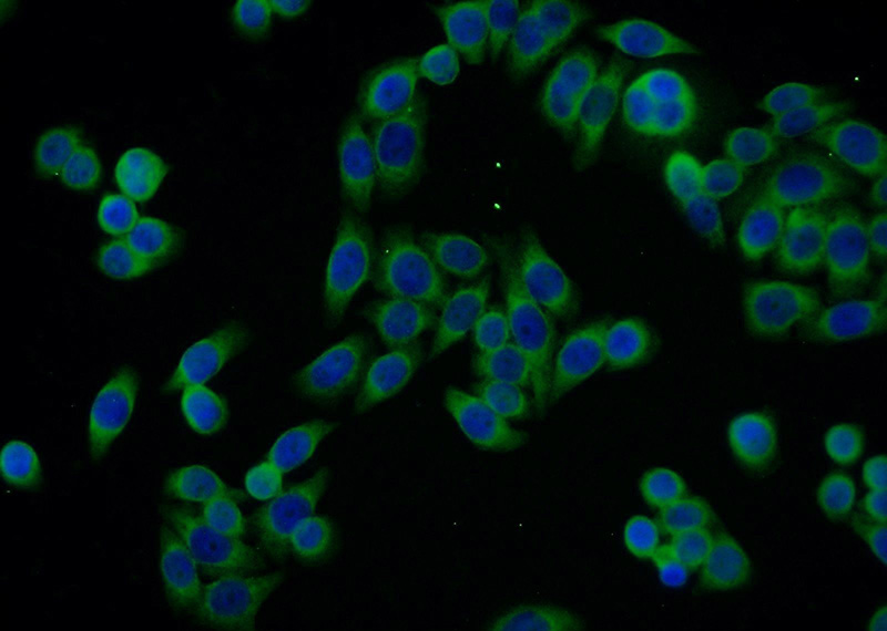 Immunofluorescent analysis of HeLa cells using Catalog No:115609(SSR4 Antibody) at dilution of 1:25 and Alexa Fluor 488-congugated AffiniPure Goat Anti-Rabbit IgG(H+L)