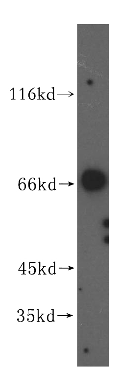 human brain tissue were subjected to SDS PAGE followed by western blot with Catalog No:116780(VPS33A antibody) at dilution of 1:500