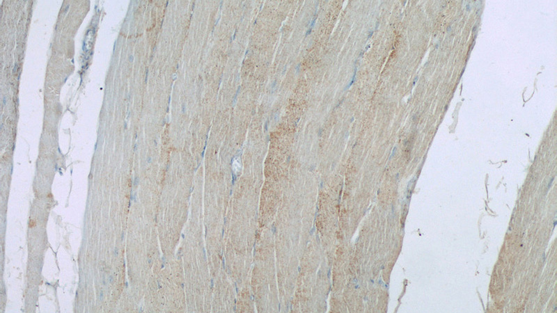 Immunohistochemistry of paraffin-embedded human skeletal muscle tissue slide using Catalog No:111079(GLUT4 Antibody) at dilution of 1:50 (under 10x lens)