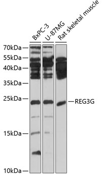 Western blot - REG3G Polyclonal Antibody 