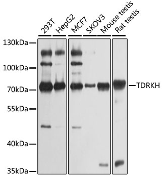 Western blot - TDRKH Polyclonal Antibody 