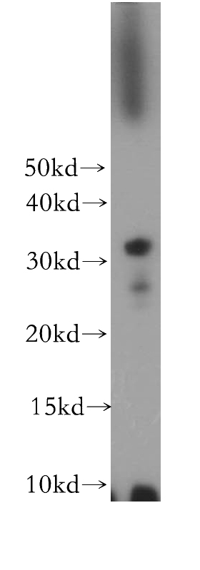 SH-SY5Y cells were subjected to SDS PAGE followed by western blot with Catalog No:112864(MS4A12 antibody) at dilution of 1:300