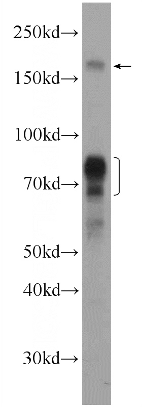 HeLa cells were subjected to SDS PAGE followed by western blot with Catalog No:113285(WHSC1L1 Antibody) at dilution of 1:600