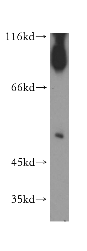 human heart tissue were subjected to SDS PAGE followed by western blot with Catalog No:115171(SGMS1 antibody) at dilution of 1:300