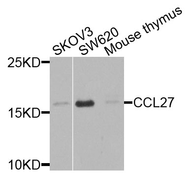 Western blot - CCL27 Polyclonal Antibody 