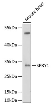 Western blot - SPRY1 Polyclonal Antibody 