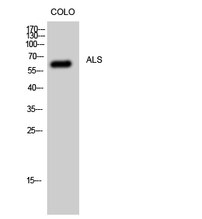 Fig1:; Western Blot analysis of CoLo cells using ALS Polyclonal Antibody