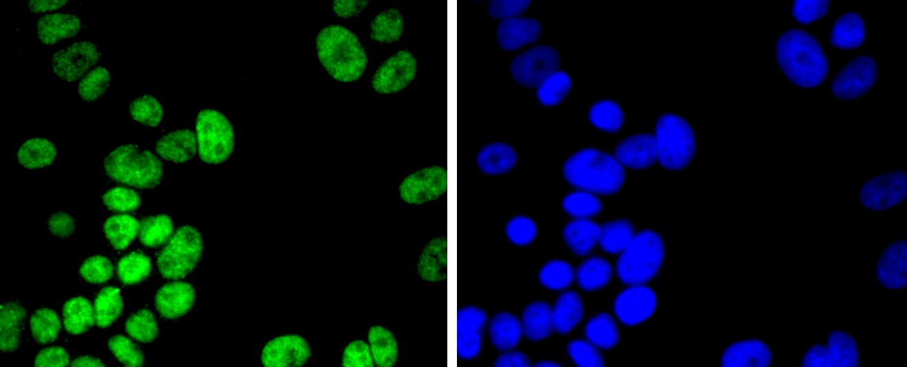 Fig3: ICC staining Histone H2B(acetyl K20) in MCF-7 cells (green). The nuclear counter stain is DAPI (blue). Cells were fixed in paraformaldehyde, permeabilised with 0.25% Triton X100/PBS.