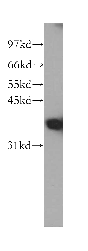 human liver tissue were subjected to SDS PAGE followed by western blot with Catalog No:110539(FBP1 antibody) at dilution of 1:500