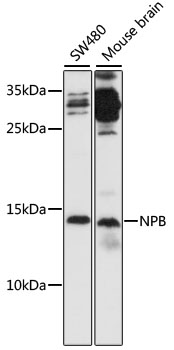 Western blot - NPB Polyclonal Antibody 