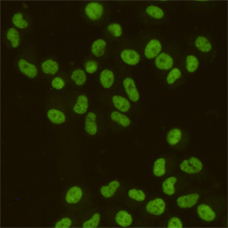 Immunocytochemistry staining of HeLa cells fixed with 4% Paraformaldehyde and using SAFB1 mouse mAb (dilution 1:200).