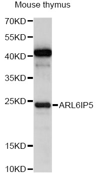 Western blot - ARL6IP5 Polyclonal Antibody 
