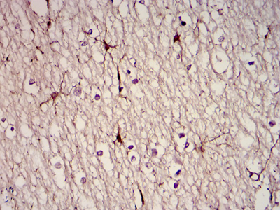 Immunohistochemical analysis of paraffin-embedded brain tissues using GFAP mouse mAb with DAB staining