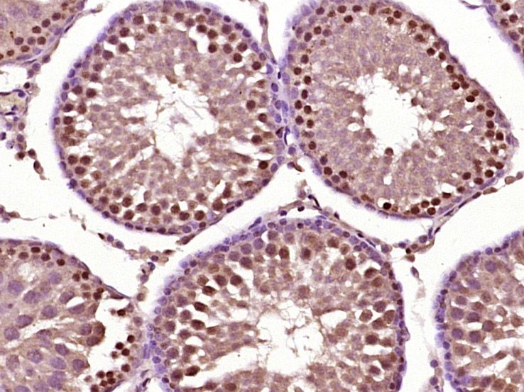 Fig3: Paraformaldehyde-fixed, paraffin embedded (rat testis tissue); Antigen retrieval by boiling in sodium citrate buffer (pH6.0) for 15min; Block endogenous peroxidase by 3% hydrogen peroxide for 20 minutes; Blocking buffer (normal goat serum) at 37℃ for 30min; Antibody incubation with (Acrosin) Polyclonal Antibody, Unconjugated at 1:400 overnight at 4℃, followed by operating according to SP Kit(Rabbit) (sp-0023) instructionsand DAB staining.